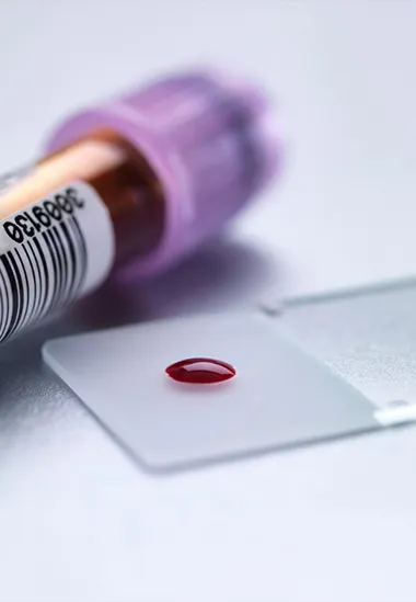 Blood test at home Dubai, Blood test in Dubai